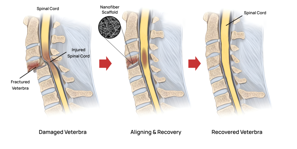 Spinal cord injury healing